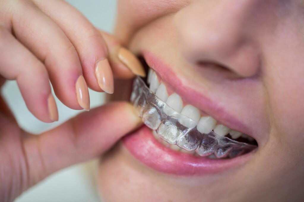Ortodontia Aparelho Dental dentista parque são lucas