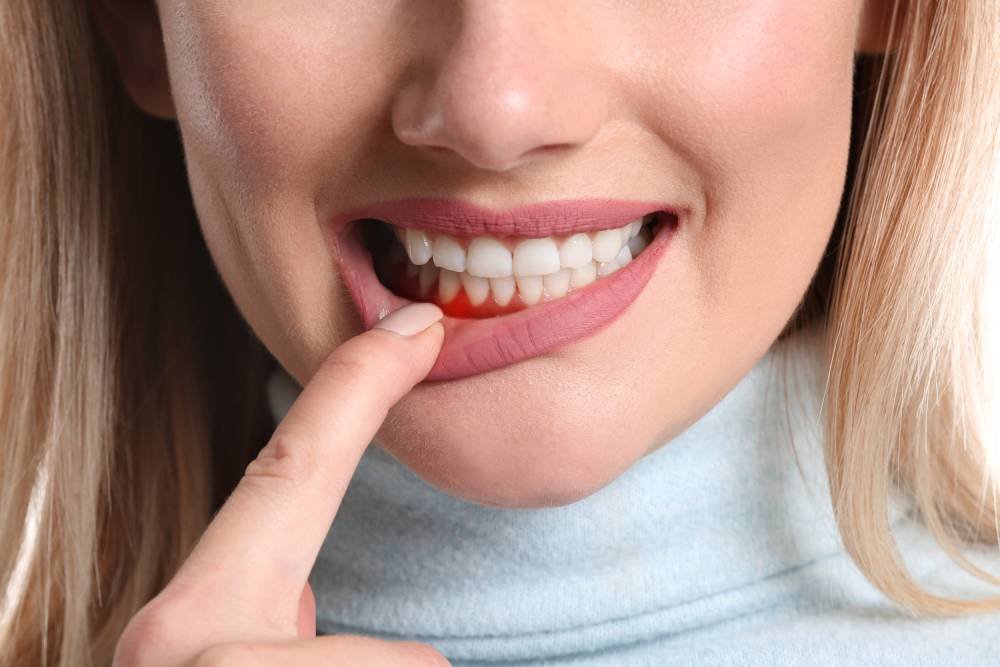 Periodontia tratamento de gengiva