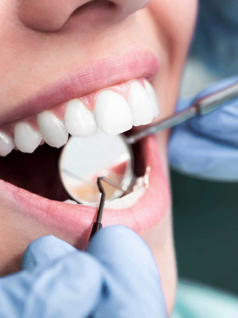 Dentista que tira mancha branca nos dentes no PQ SÃO LUCAS