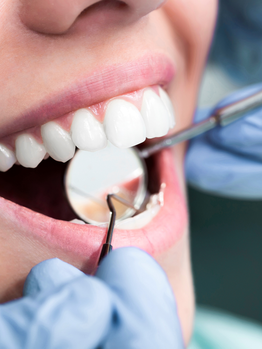 Dentista que tira mancha branca nos dentes no PQ SÃO LUCAS